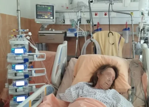 Soins intensifs respiratoires